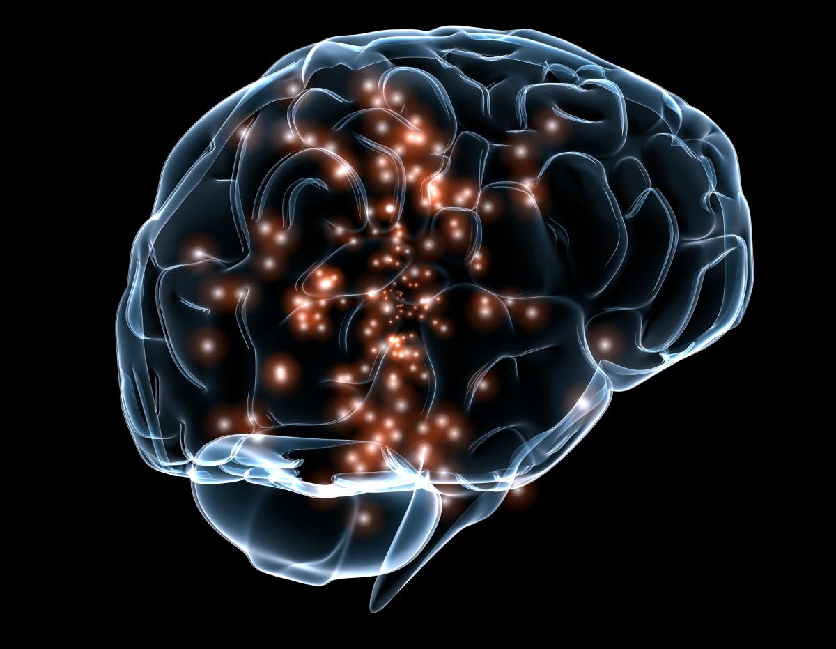 Non-invasive brain stimulation