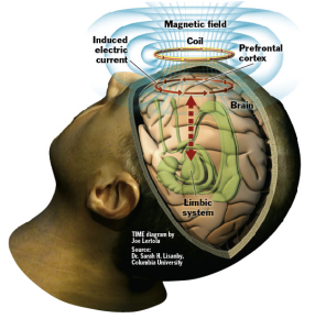 brain currents